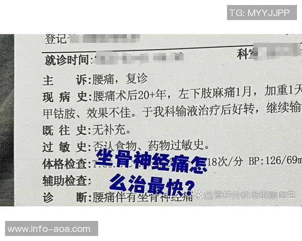 专家解读坐骨神经痛成因及治疗方法大多数患者可避免手术治疗